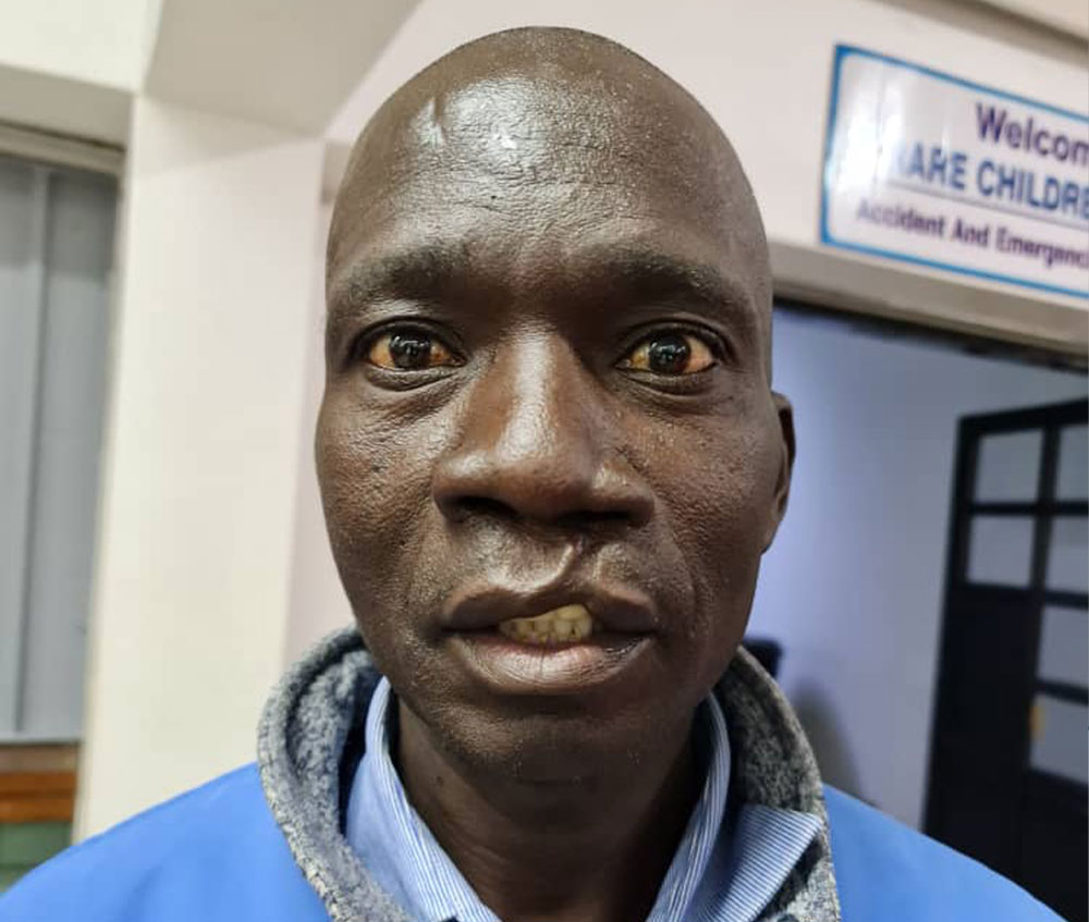 Mandigaisa just before cleft surgery