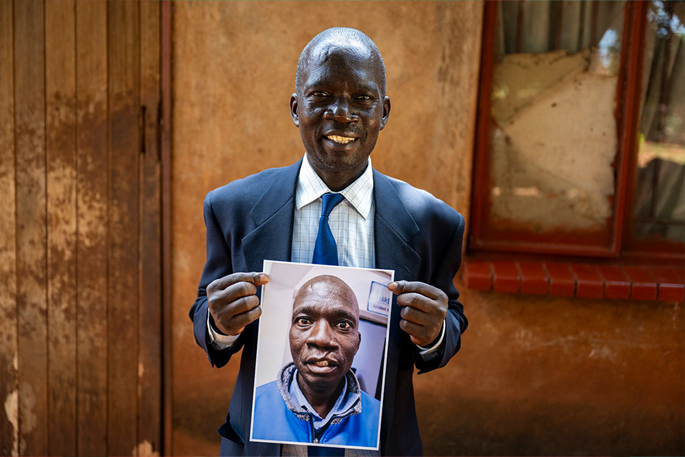 Mandi holding a picture of himself before surgery