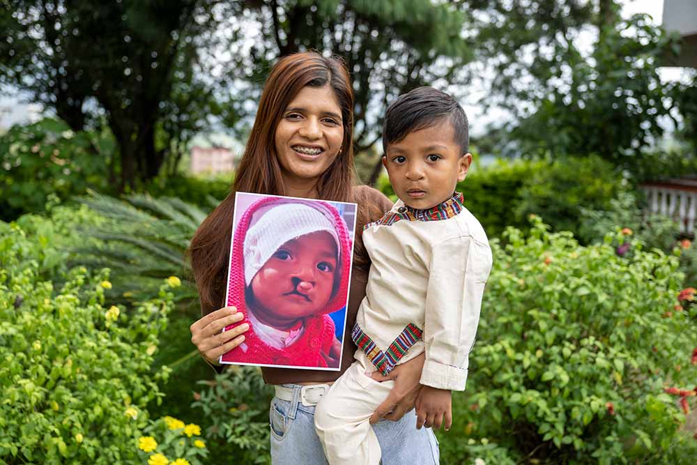 Priscilla holds up Asher, along with a picture of him before cleft palate surgery